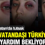 afganistanda-alikonulmustu-cansu-badur-turkiyeden-yardim-istiyor-VXNcEhi2